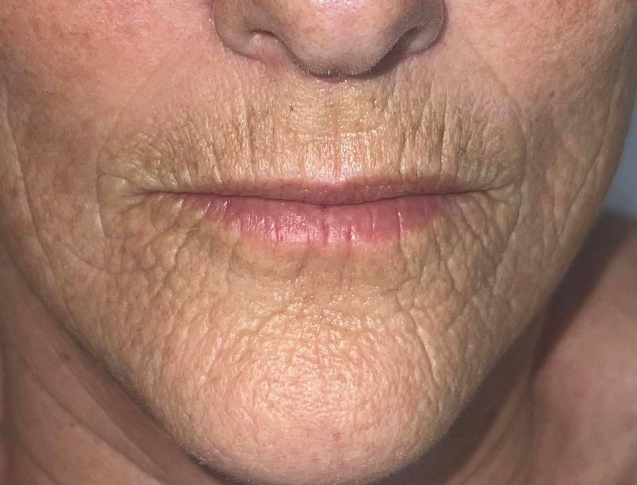 Cara mencegah glycation kulit